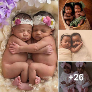 "Embracing the Individuality of Identical Black Twin Babies"